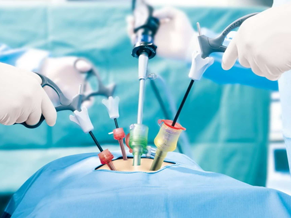 Laparoscopic Gallstone & Hernia Surgery in Bareilly - Anis Hospital